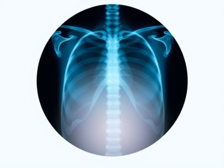 X Ray Is A Painful Procedure