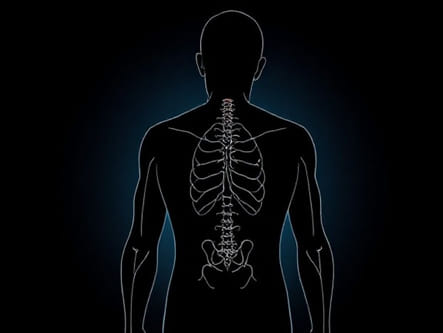 Procedure To Cauterize Nerves In Back