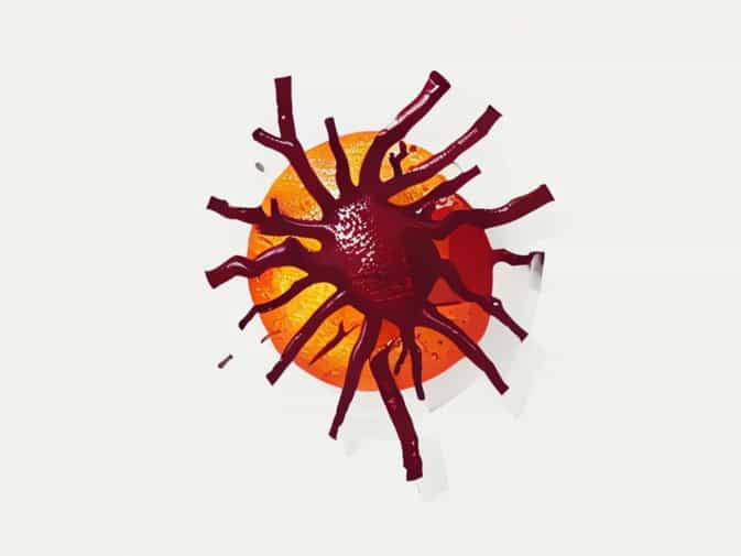 Can Septicemia Cause Jaundice