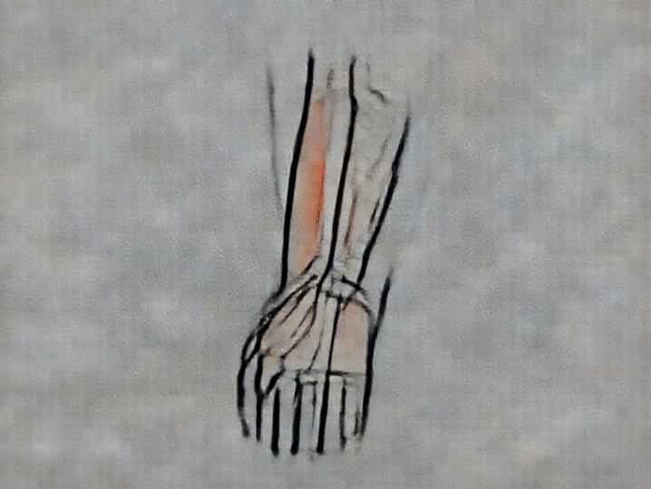Anterior Compartment Of Forearm