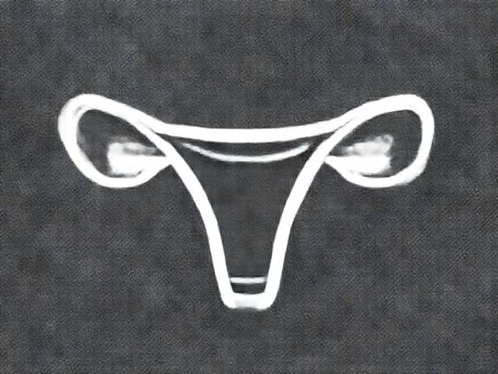 Getting Fallopian Tubes Removed