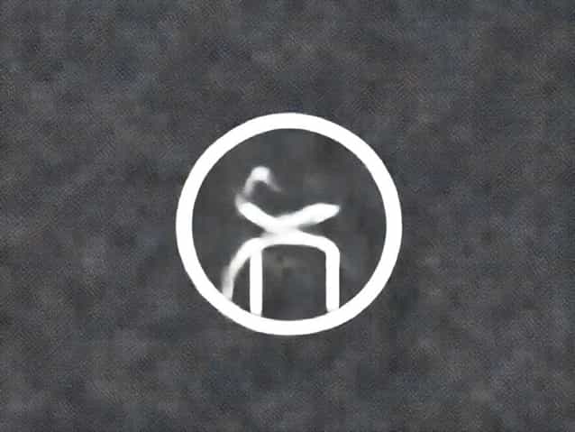 Not Waking Up From Induced Coma