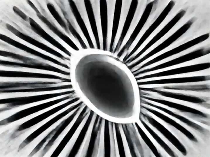 What Causes Flagellate Erythema