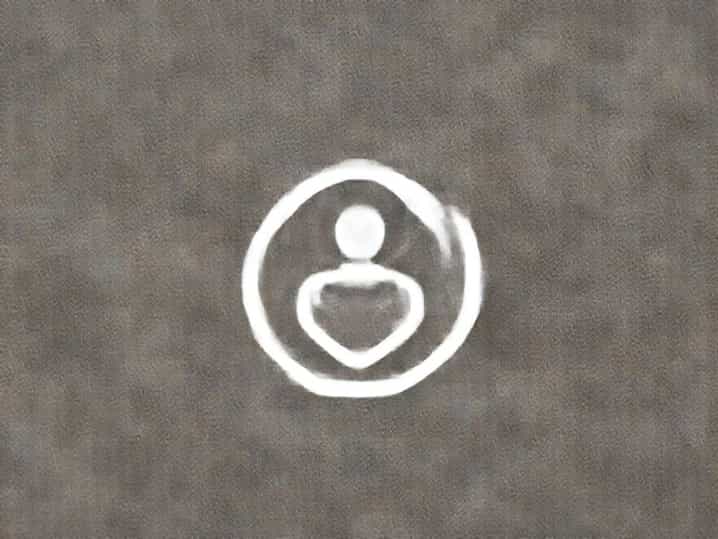 What Is Transitional Protection