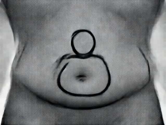 Why Is My Midsection So Bloated