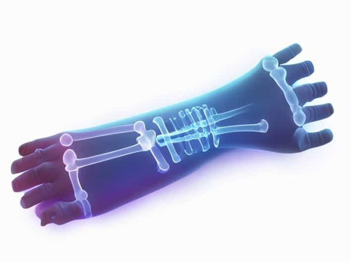 X Ray Of Wrist Joint Of Neonate